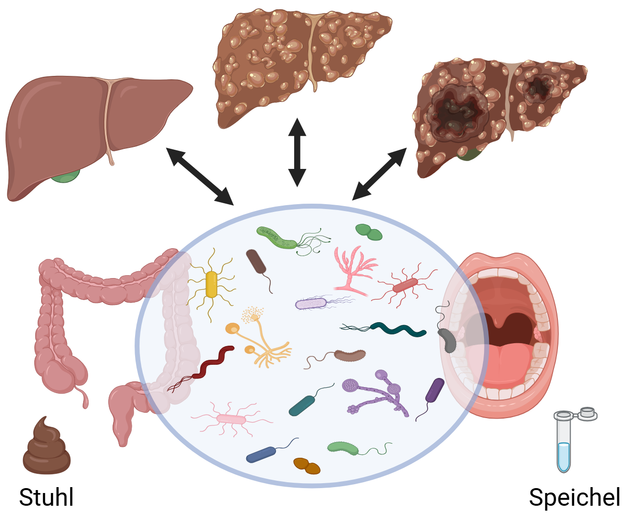 Die Grafik zeigt eine gesunde und zwei kranke Lebern. Sie illustriert den Zusammenhang zwischen der Mikrobiota im Darm und Speichel mit verschiedenen Lebererkrankungen.